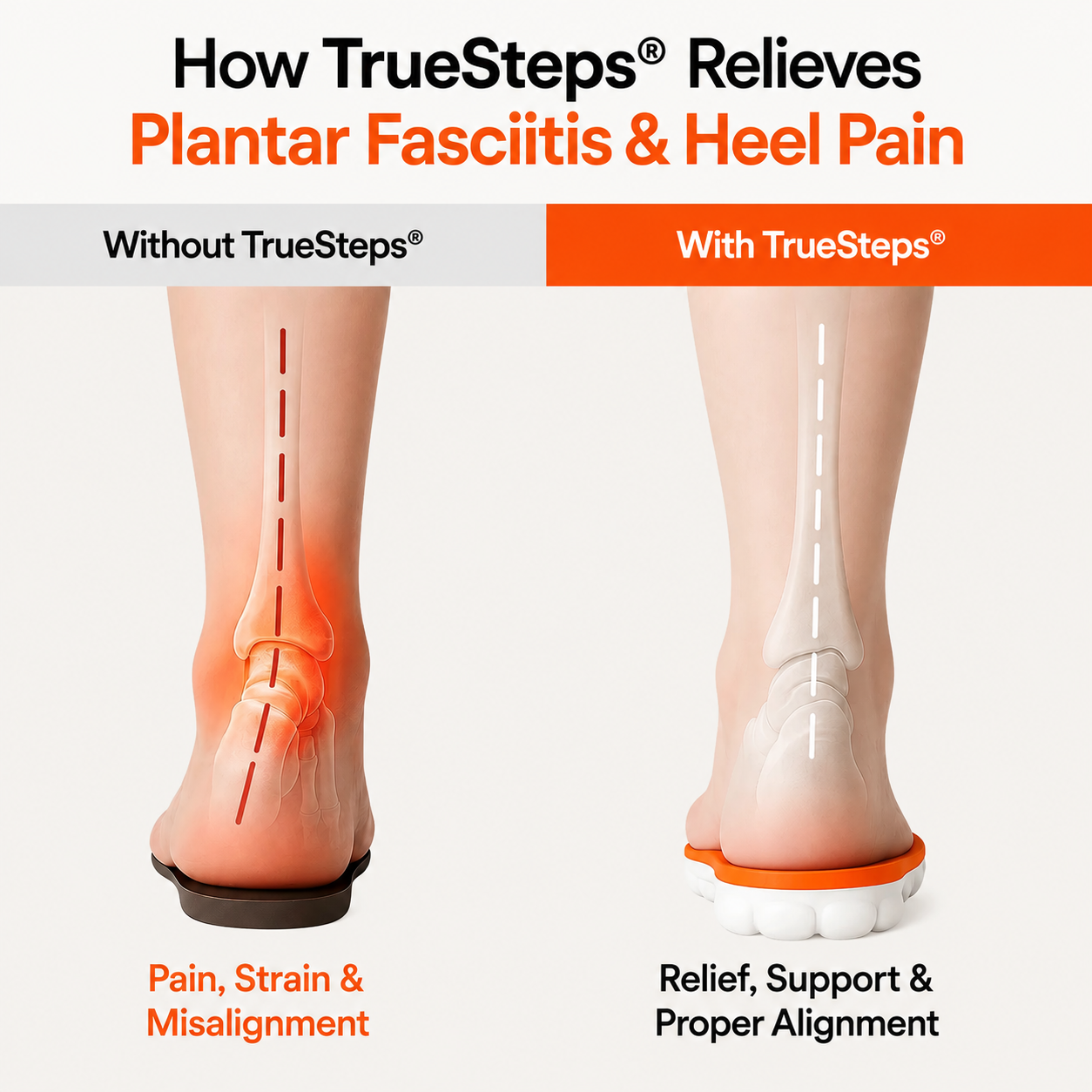 TrueSteps® Orthopedic Massage Insoles – Heel Pain & Plantar Fasciitis Relief